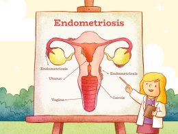 Endometriosis and Thyroid Diet Plan ( Indian Menu )